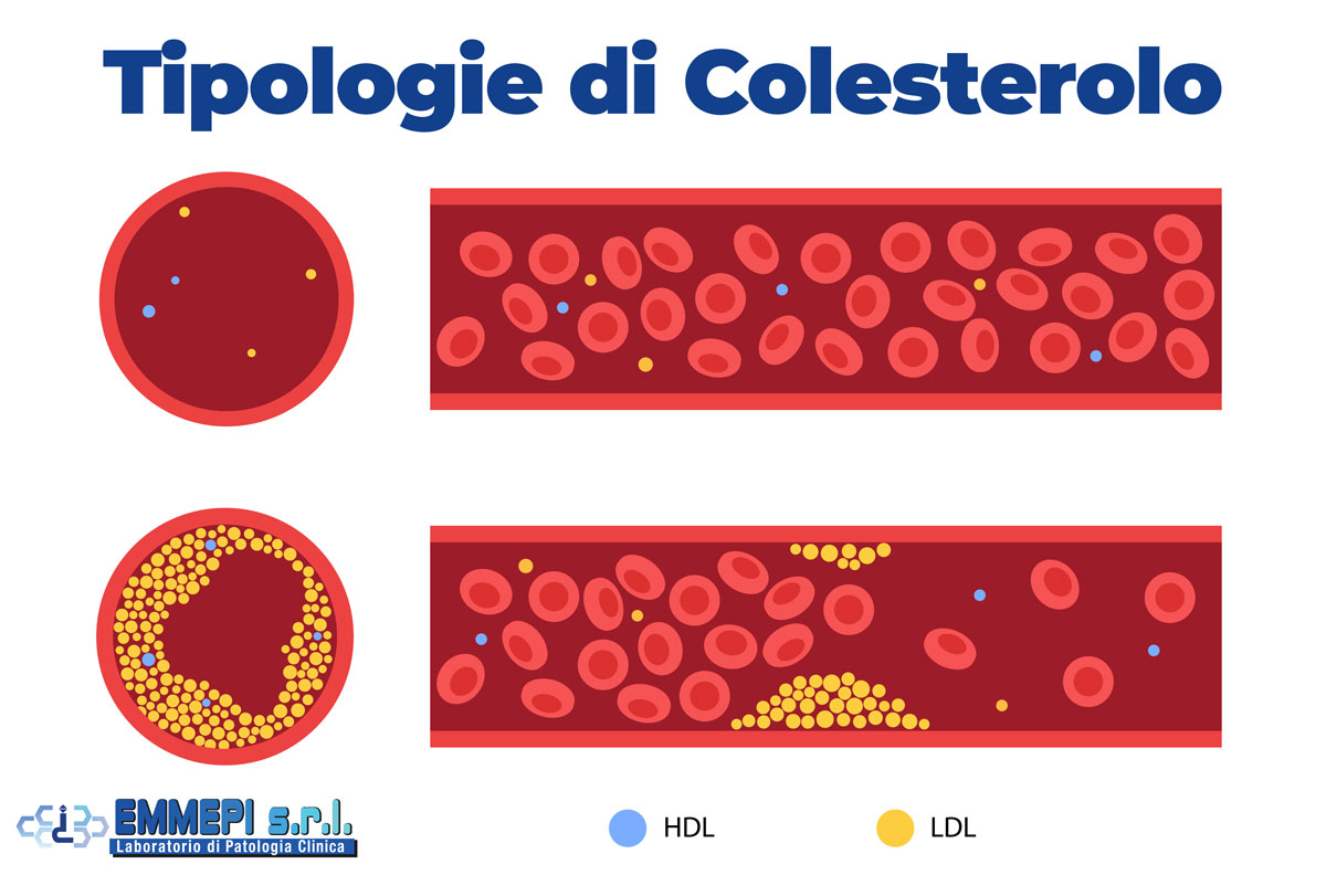 esami per il colesterolo