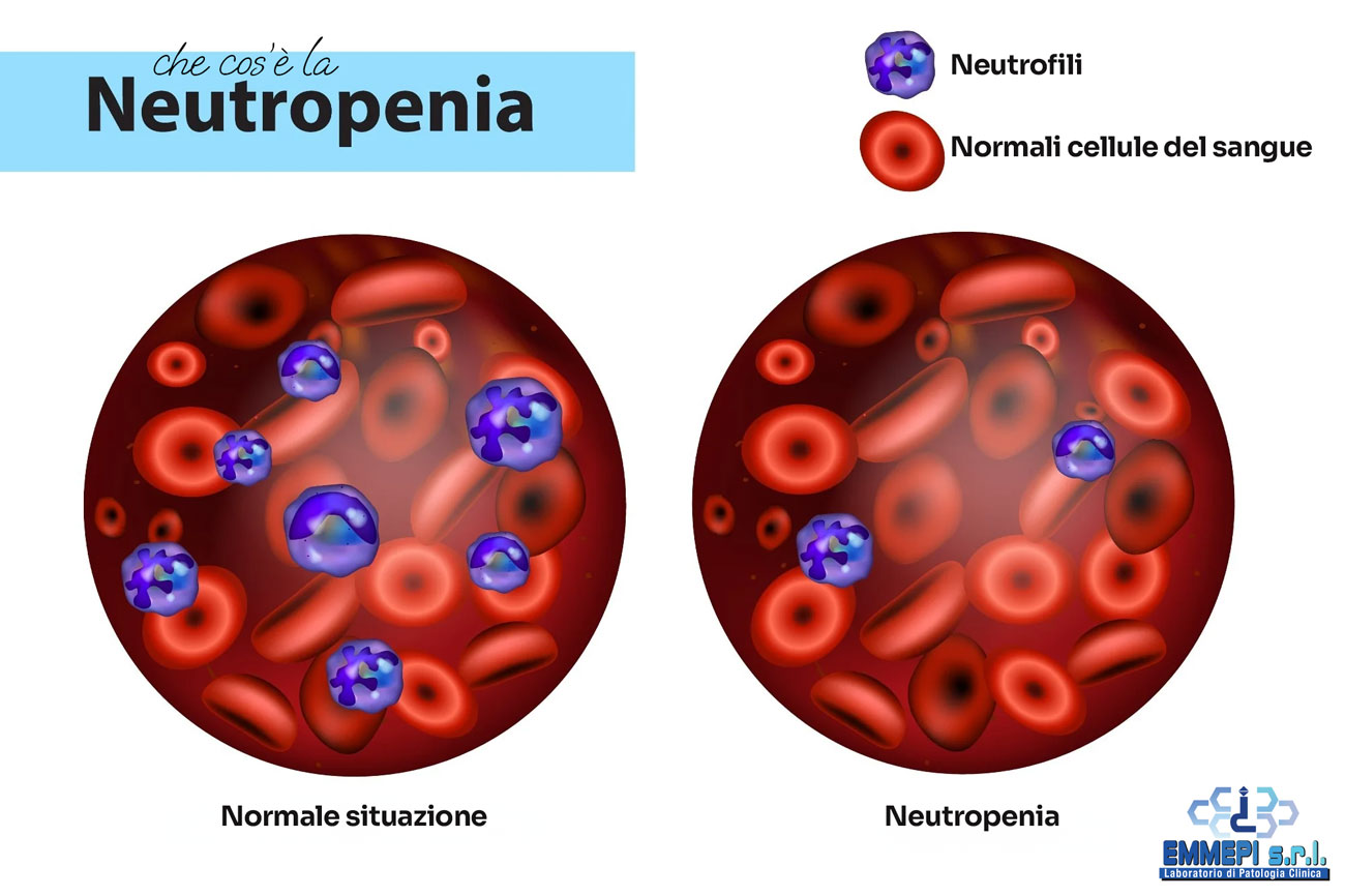 neutropenia