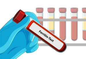 Ferritina alta: cause, sintomi e cosa fare per abbassarla