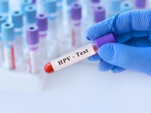 HPV Test: cos’è, come si fa e perché è importante